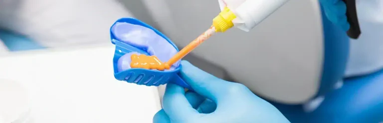 Diş protezleri için ölçü malzemeleri nasıl seçilir