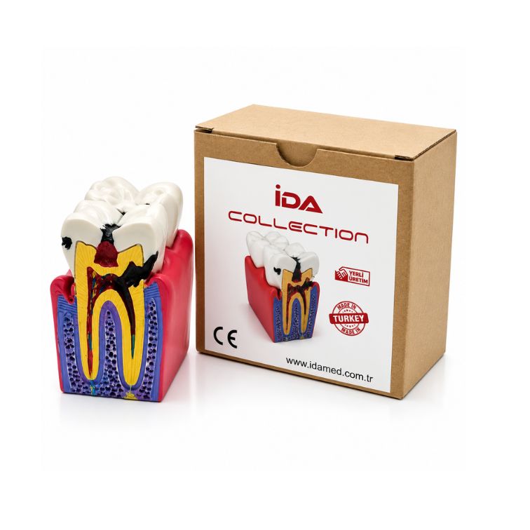 Diş Çürüğü Eğitim Modeli (Gerçekçi Dental Eğitim Maketi)