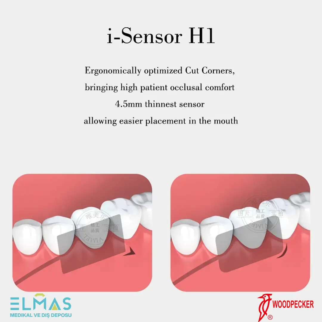 Woodpecker Dental i-Sensor H1 Dijital X-Ray RVG Görüntüleme Sistemi - Görsel 6