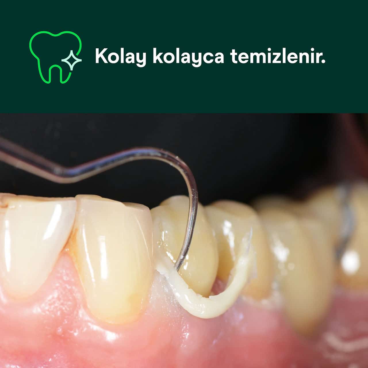 3M RelyX Universal Rezin Siman Deneme Kiti – TR / A1 Renk - Görsel 4